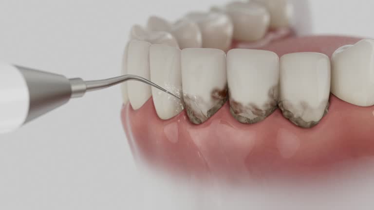 Reliable Emergency Dentist contractor in Irvine, CA by Smile Center Dentistry